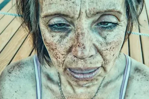 מַרְאֶה רַע